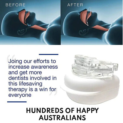 Anti-Snoring Mouthpiece